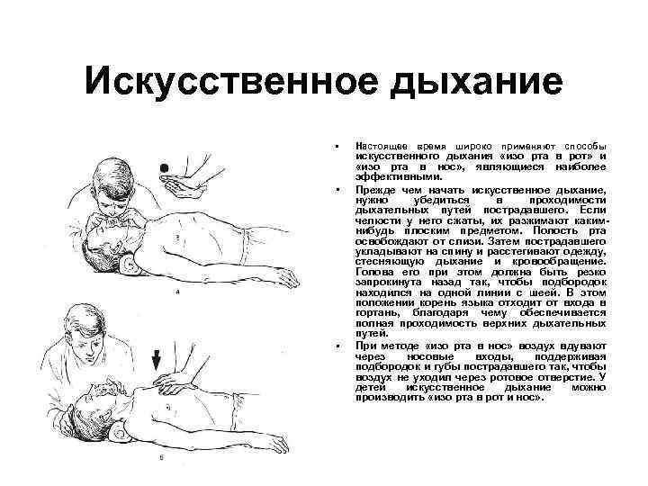 Искусственное дыхание • • • Настоящее время широко применяют способы искусственного дыхания «изо рта