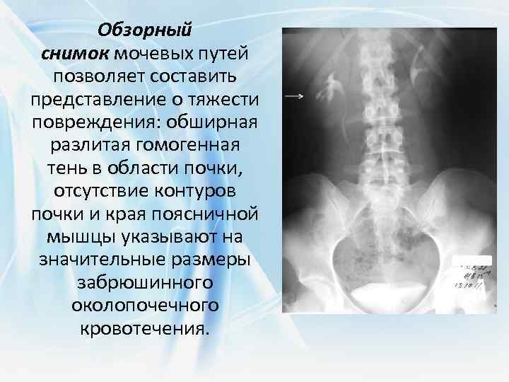 Обзорный снимок