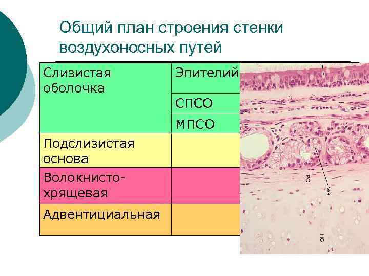 Общий план строения стенки воздухоносных путей Слизистая оболочка Эпителий СПСО МПСО Подслизистая основа Волокнистохрящевая