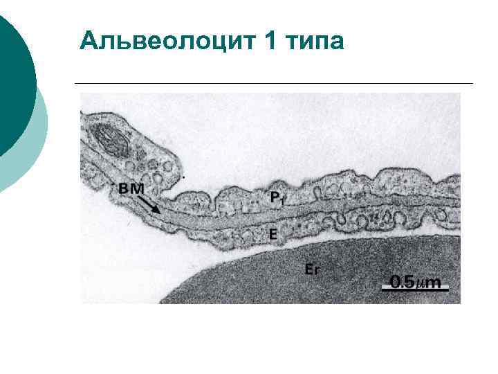 Альвеолоцит 1 типа 