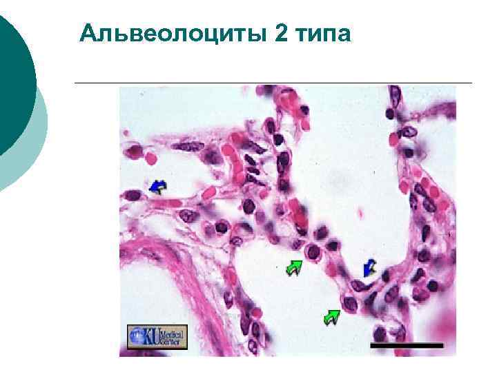 Альвеолоциты 2 типа 