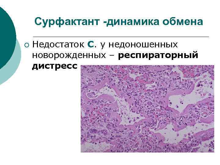 Сурфактант -динамика обмена ¡ Недостаток С. у недоношенных новорожденных – респираторный дистресс 