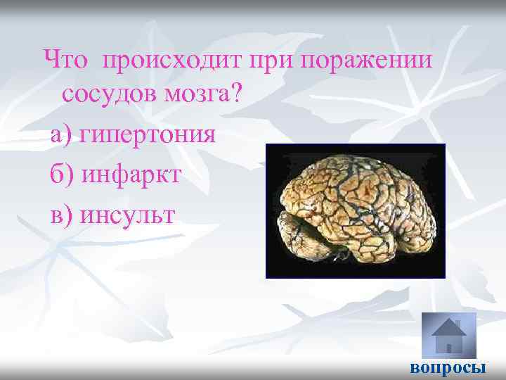 Поражение сосудов мозга. Уточненные поражения сосудов мозга. Другие уточненные поражения сосудов мозга. Уточнение поражение сосудов мозга. 167.8 Другие уточненные поражения сосудов мозга.