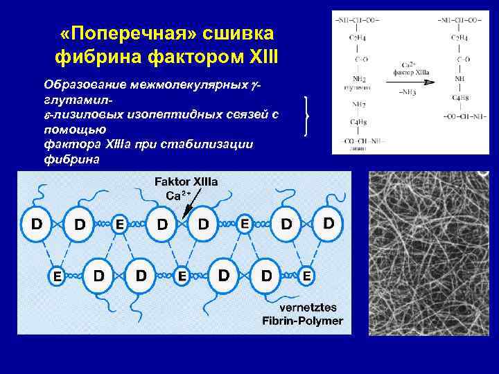  «Поперечная» сшивка фибрина фактором XIII Образование межмолекулярных глутамил -лизиловых изопептидных связей с помощью