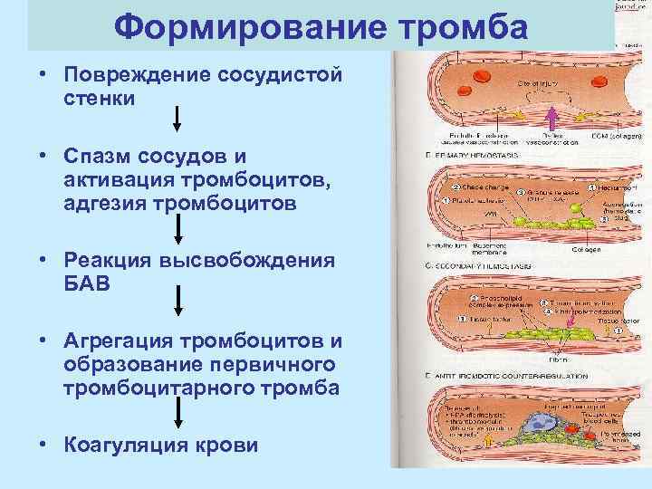 Формирование тромба • Повреждение сосудистой стенки • Спазм сосудов и активация тромбоцитов, адгезия тромбоцитов