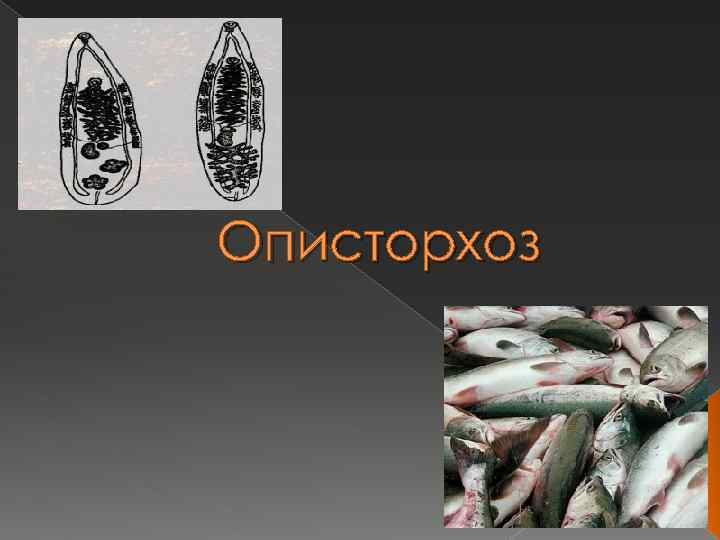 Описторхоз 