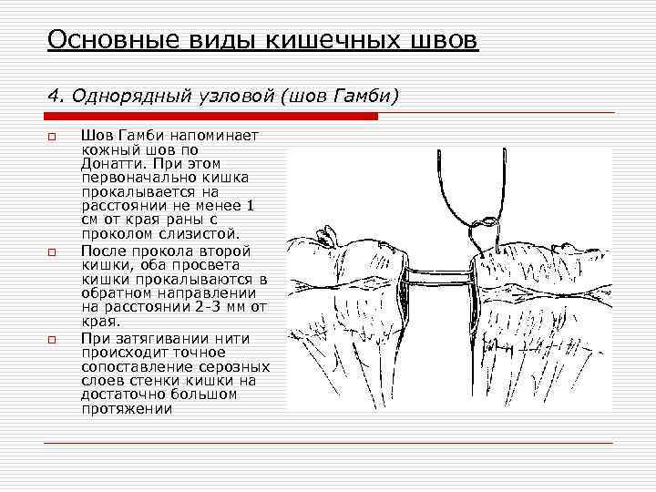 Основные виды кишечных швов 4. Однорядный узловой (шов Гамби) o o o Шов Гамби