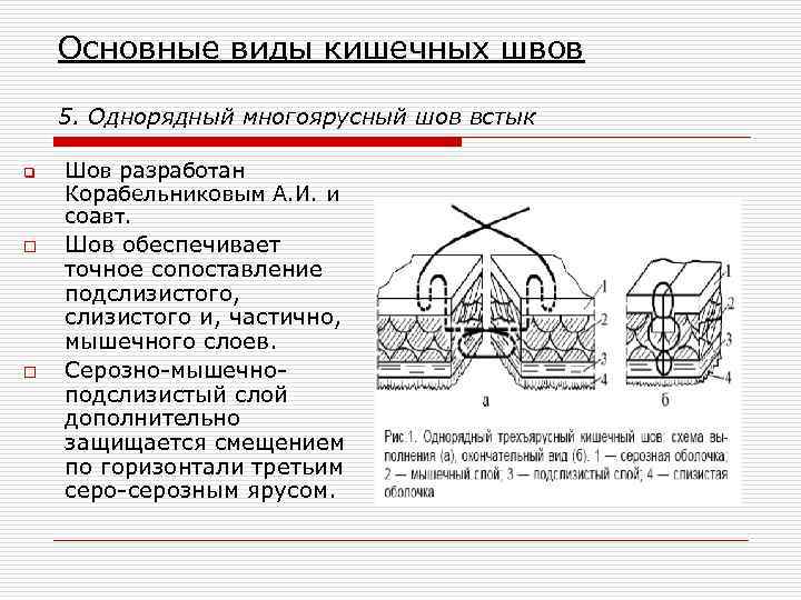 Основные виды кишечных швов 5. Однорядный многоярусный шов встык q o o Шов разработан