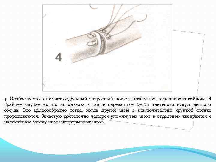 Особое место занимает отдельный матрасный шов с плитками из тефлонового войлока. В крайнем случае