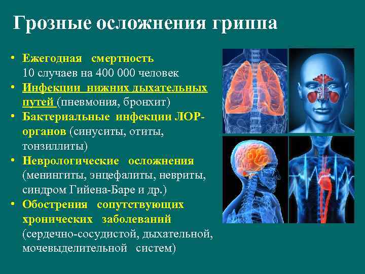 Грозные осложнения гриппа • Ежегодная смертность 10 случаев на 400 000 человек • Инфекции