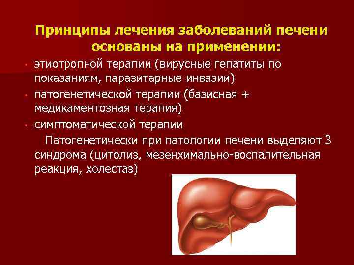 Принципы лечения заболеваний печени основаны на применении: • • • этиотропной терапии (вирусные гепатиты
