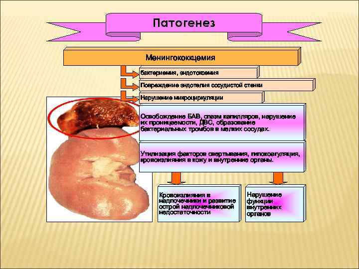 Патогенез Менингококкцемия бактериемия, эндотоксемия Повреждение эндотелия сосудистой стенки Нарушение микроциркуляции Освобождение БАВ, спазм капилляров,