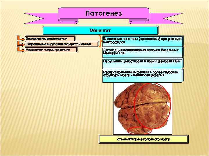 Патогенез Менингит бактериемия, эндотоксемия Повреждение эндотелия сосудистой стенки Нарушение микроциркуляции Выделение эластазы (протеиназы) при