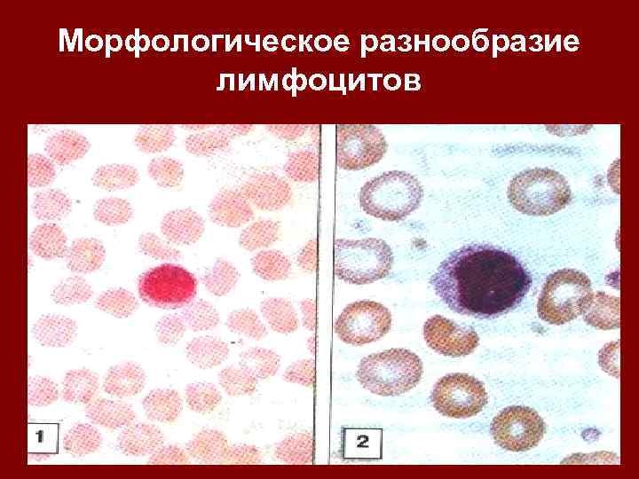 Морфологическое разнообразие лимфоцитов 