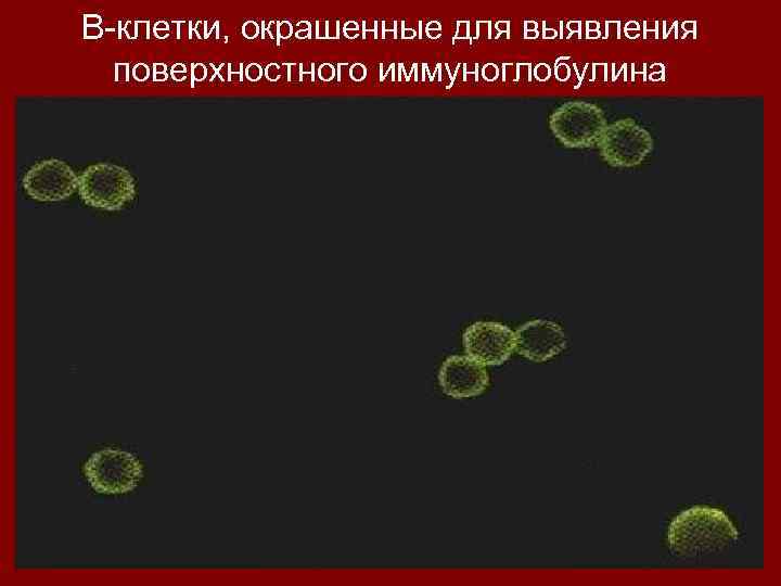 В-клетки, окрашенные для выявления поверхностного иммуноглобулина 