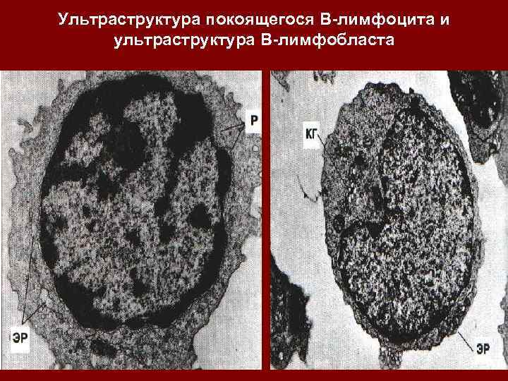 Ультраструктура покоящегося В-лимфоцита и ультраструктура В-лимфобласта 