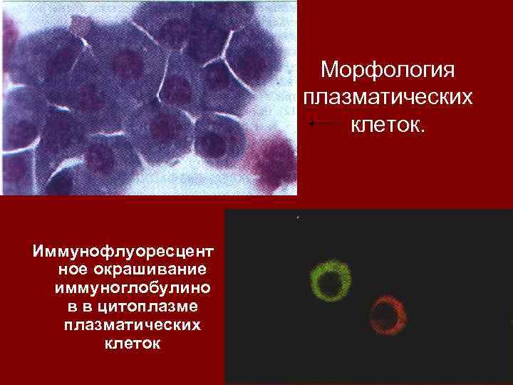 Морфология плазматических клеток. Иммунофлуоресцент ное окрашивание иммуноглобулино в в цитоплазме плазматических клеток 