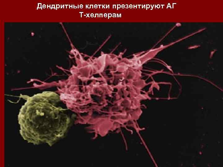 Вакцина дендритными клетками. Дендритная клетка Рецептор презентирующий антиген. Дендритные клетки кишечника. Культивирование ex vivo дендритные клетки. Клетка дендритная акварель.