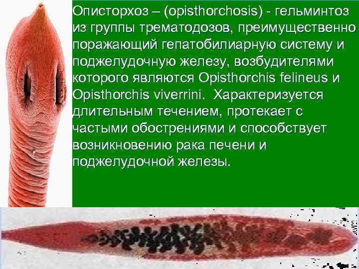 l Описторхоз – (opisthorchosis) - гельминтоз из группы трематодозов, преимущественно поражающий гепатобилиарную систему и