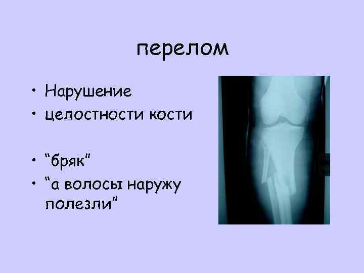 перелом • Нарушение • целостности кости • “бряк” • “а волосы наружу полезли” 