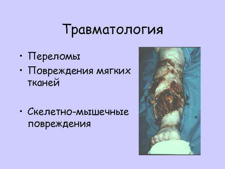 Травматология • Переломы • Повреждения мягких тканей • Скелетно-мышечные повреждения 