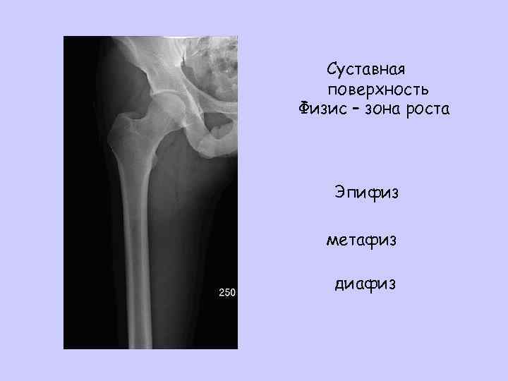 Суставная поверхность Физис – зона роста Эпифиз метафиз диафиз 