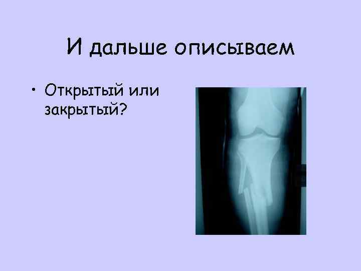 И дальше описываем • Открытый или закрытый? 