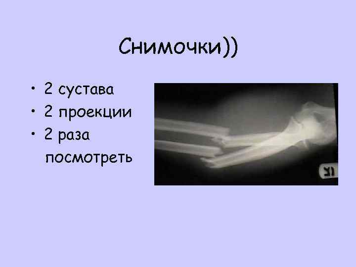 Снимочки)) • 2 сустава • 2 проекции • 2 раза посмотреть 