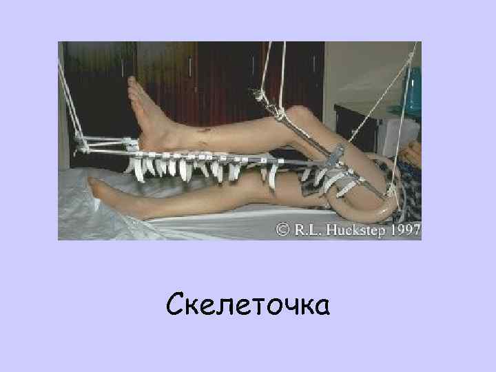 Скелеточка 