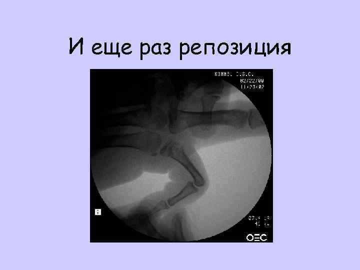 И еще раз репозиция 