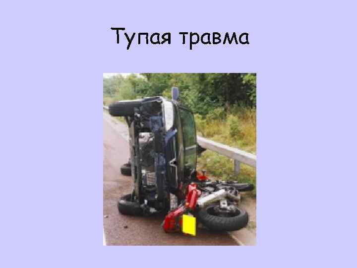 Тупая травма 