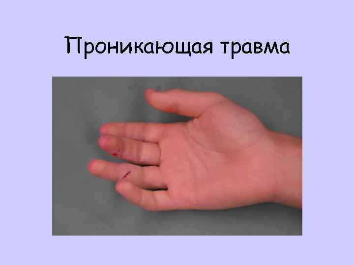 Проникающая травма 