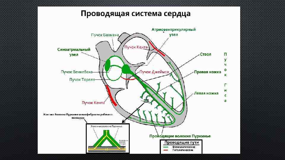 Лекция по теме Синдром слабости синусового узла и мерцательная аритмия 