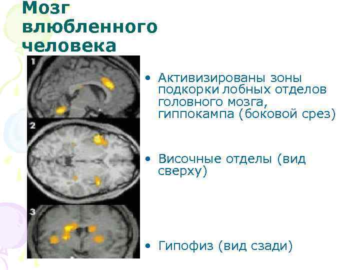 Мозг влюбленного человека • Активизированы зоны подкорки лобных отделов головного мозга, гиппокампа (боковой срез)