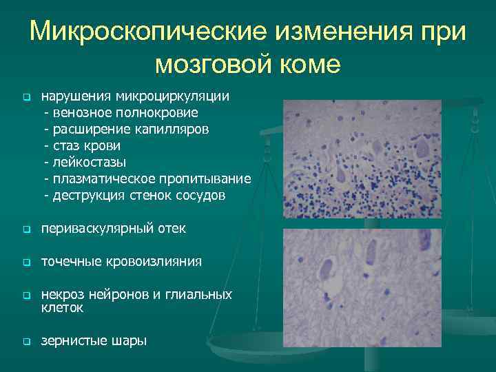 Микроскопические изменения при мозговой коме нарушения микроциркуляции - венозное полнокровие - расширение капилляров -