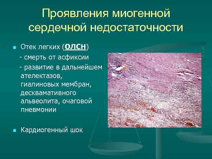Проявления миогенной сердечной недостаточности Отек легких (ОЛСН) - смерть от асфиксии - развитие в