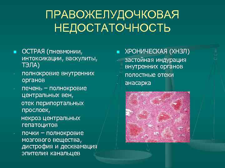 ПРАВОЖЕЛУДОЧКОВАЯ НЕДОСТАТОЧНОСТЬ ОСТРАЯ (пневмонии, интоксикации, васкулиты, ТЭЛА) полнокровие внутренних органов печень – полнокровие центральных