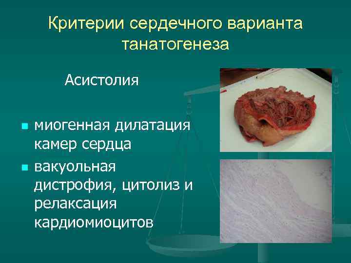 Критерии сердечного варианта танатогенеза Асистолия n n миогенная дилатация камер сердца вакуольная дистрофия, цитолиз