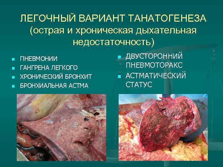 ЛЕГОЧНЫЙ ВАРИАНТ ТАНАТОГЕНЕЗА (острая и хроническая дыхательная недостаточность) n n ПНЕВМОНИИ ГАНГРЕНА ЛЕГКОГО ХРОНИЧЕСКИЙ