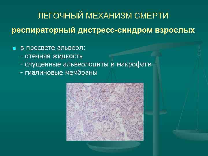 ЛЕГОЧНЫЙ МЕХАНИЗМ СМЕРТИ респираторный дистресс-синдром взрослых n в просвете альвеол: - отечная жидкость -