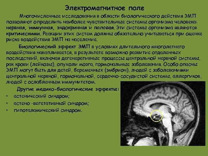 Электромагнитное поле Многочисленные исследования в области биологического действия ЭМП позволяют определить наиболее чувствительные системы