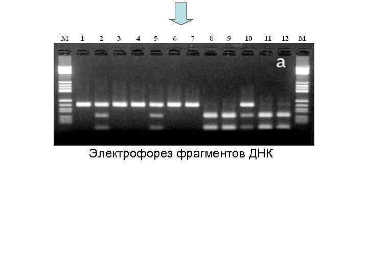 Электрофорез карта осу