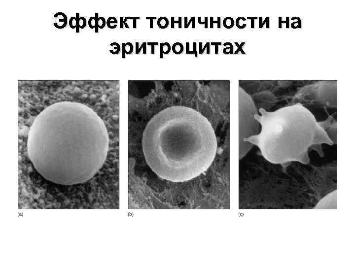 Эффект тоничности на эритроцитах 