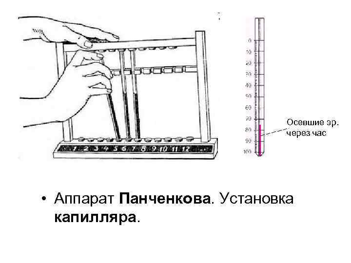 Осевшие эр. через час • Аппарат Панченкова. Установка капилляра. 