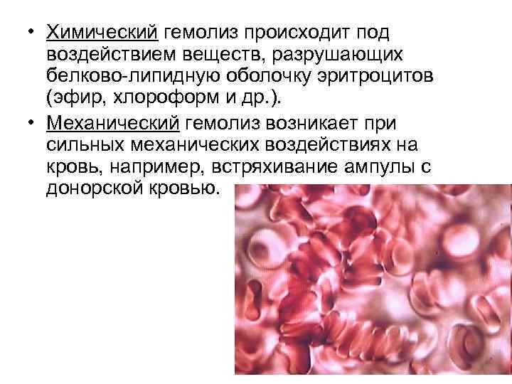 Гемолиз вопрос ответ. Химический гемолиз эритроцитов. Гемолиз эритроцитов причины. Разрушение эритроцитов в печени. Эритроциты разрушаются в.