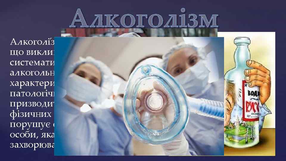 Алкоголізм Алкоголі зм — захворювання, що викликається систематичним вживанням алкогольних напоїв, що характеризується патологічним
