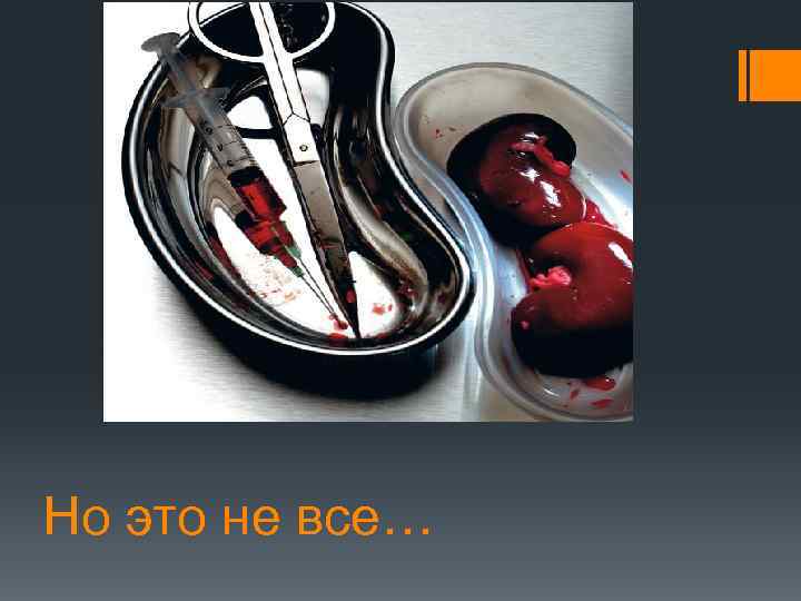 Но это не все… 