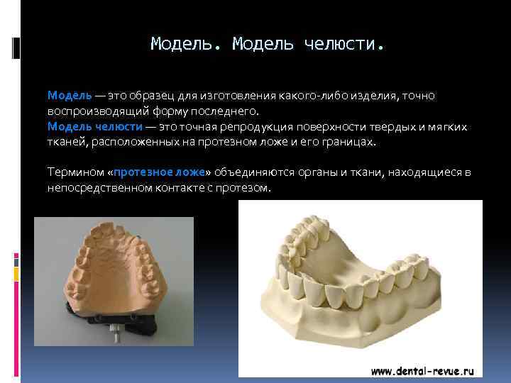 Модель челюсти. Модель — это образец для изготовления какого-либо изделия, точно воспроизводящий форму последнего.