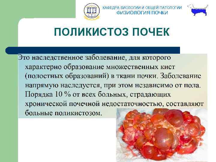 КАФЕДРА БИОЛОГИИ И ОБЩЕЙ ПАТОЛОГИИ ФИЗИОЛОГИЯ ПОЧКИ ПОЛИКИСТОЗ ПОЧЕК 