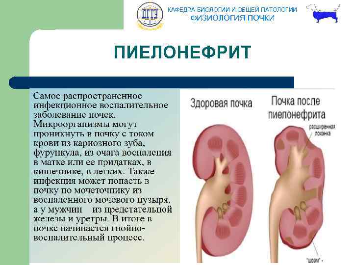 КАФЕДРА БИОЛОГИИ И ОБЩЕЙ ПАТОЛОГИИ ФИЗИОЛОГИЯ ПОЧКИ ПИЕЛОНЕФРИТ 